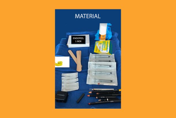 required material for endopeel techniques